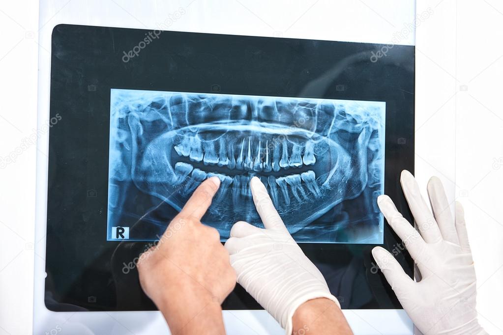 Examining teeth X Ray