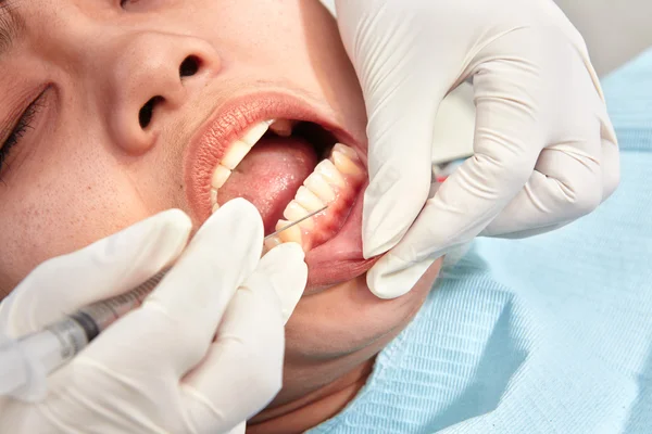 Bliska badania zębów — Zdjęcie stockowe