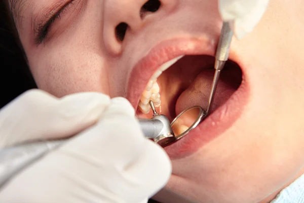 Primo piano esame dei denti — Foto Stock