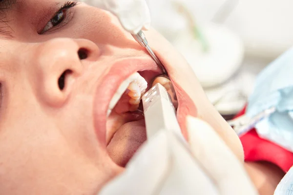 Close up teeth examination — Stock Photo, Image