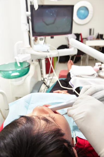 Dentes vídeo alimentação — Fotografia de Stock