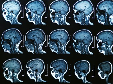 MRI Brain Scan clipart