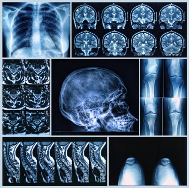 Radiography of Human Bones clipart
