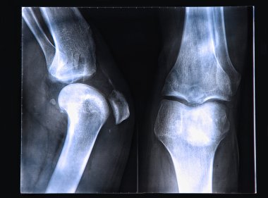 diz x-ray