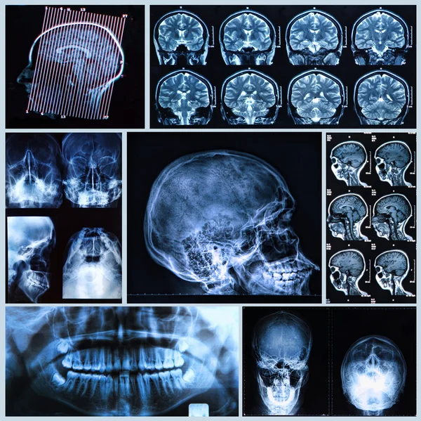 Baş ve boyun anatomisi — Stok fotoğraf