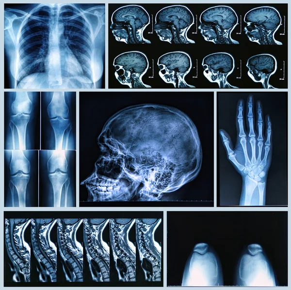Röntgenaufnahme menschlicher Knochen Stockbild