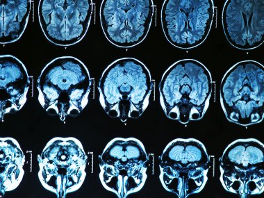 MRI Brain Scan clipart