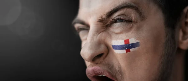 Ένας άνδρας που ουρλιάζει με την εικόνα της εθνικής σημαίας των Ολλανδικών Αντιλλών στο πρόσωπό του — Φωτογραφία Αρχείου