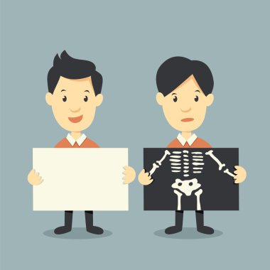 holding kağıt ve x ışını onay kemikler