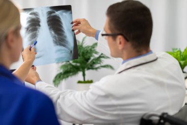 Bir doktor ve hemşire hastanın akciğerlerinin fotoğrafına bakar..