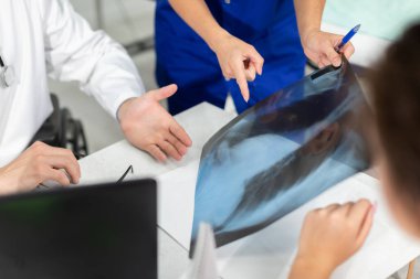 Doktorlar hastaya neden akciğerlerinde ağrı olduğunu açıklar..
