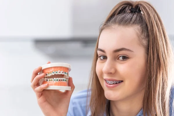 Модель Зубных Скобок Руке Молодой Девушки Выровненными Зубами — стоковое фото