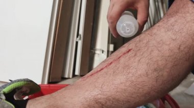 Adamın bacağında taze bir yara. İlaç tedavisi görmüş. Yara sırılsıklam olmuş ve pamukla kurumuş. Enfeksiyondan kaynaklanan yaralar. İlaçlar. Boşluğu kopyala