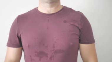 Üzerinde ter lekesi olan bir adam. Sıcaktan terliyor. Hiperhidroz sorunu