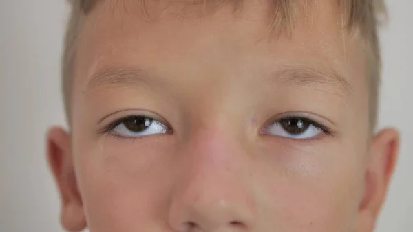 Close Boy Rolls His Eyes Sad Unhappy Emotions Child — Fotografia de Stock