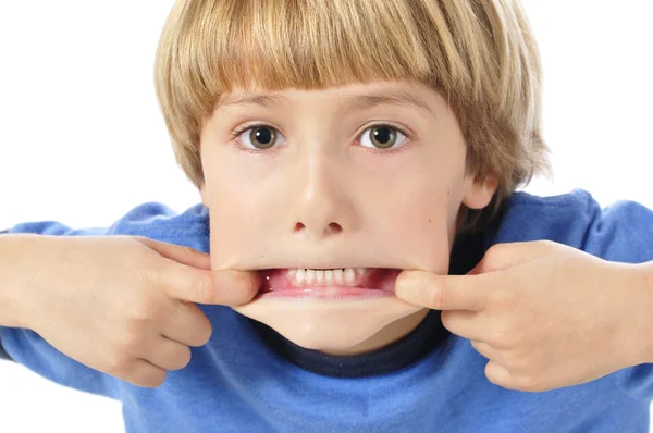 Teethy roliga ansikte — Stockfoto