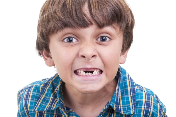 Missing baby teeth — Stock Photo, Image