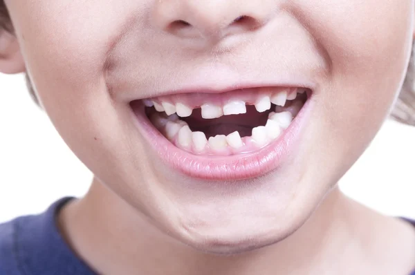 Baby teeth — Stock Photo, Image