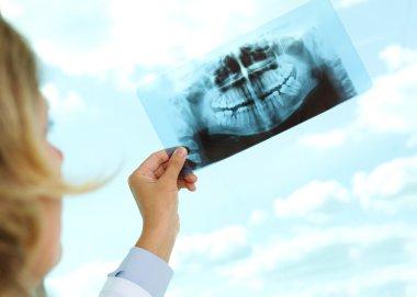 x-ray arıyorsunuz