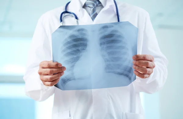 Doctor with x-ray — Stock Photo, Image