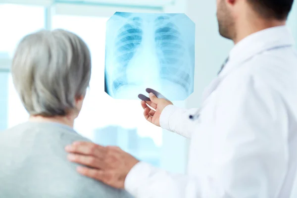 Looking at x-ray — Stock Photo, Image