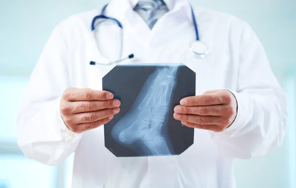 X-ray of foot — Stock Photo, Image