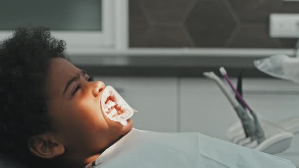 Вид Сбоку Испуганного Черного Десятилетнего Мальчика Лежащего Стоматологическом Кресле Зубном — стоковое видео