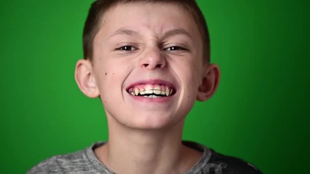 Mosolyogj bébi, a fiú tányért visel a fogak összehangolására, fogápolásra.. — Stock videók