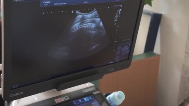 Dolyna, Oekraïne 13 juli 2021: Ultrasone diagnose voor zwangere vrouwen, regelmatige controle en onderzoek van de foetus van een zwangere vrouw. — Stockvideo
