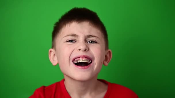 歯のプレートと歯のケアと彼の歯を合わせて、男の子は笑っている. — ストック動画