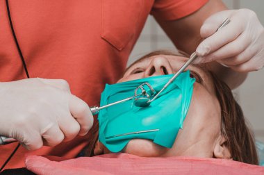 Diş kliniğinde yanak retraktörü olan bir hasta, lateks eldivenli bir dişçi dişlerini boron ve aynayla muayene ediyor, dişçiye gidiyor..