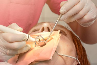 Diş kliniğinde yanak retraktörü olan bir hasta, lateks eldivenli bir dişçi dişlerini boron ve aynayla muayene ediyor, dişçiye gidiyor..
