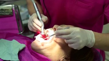 Dişçi dişleri matkap, diş prosedürü, diş tedavisi ve ağız bakımıyla temizler..