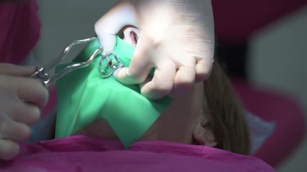 Dentista Estabelece Cofres Paciente Procedimento Odontológico Tratamento Odontológico Moderno Tratamento — Vídeo de Stock