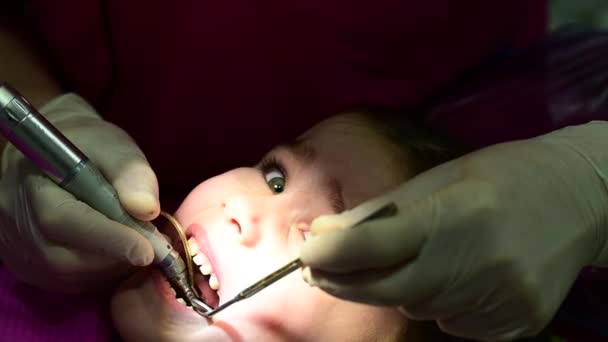 治疗小孩的乳牙 医生为蛀牙操练牙齿 看牙医 — 图库视频影像