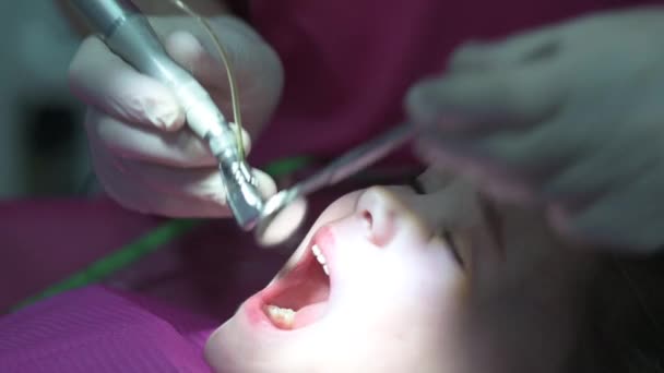 Θεραπεία Των Δοντιών Του Μωρού Ένα Παιδί Ένας Γιατρός Τρυπά — Αρχείο Βίντεο