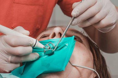 Diş kliniğinde yanak retraktörü olan bir hasta, lateks eldivenli bir dişçi dişlerini boron ve aynayla muayene ediyor, dişçiye gidiyor..