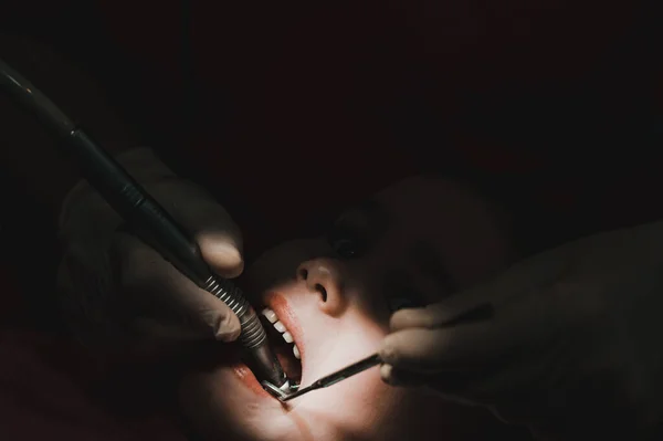 Tratamento Dentes Leite Uma Criança Uma Menina Dentista Exame Tratamento — Fotografia de Stock