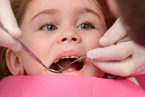 Ein Kleines Mädchen Sitzt Einem Für Den Eingriff Vorbereiteten Zahnarztstuhl — Stockfoto