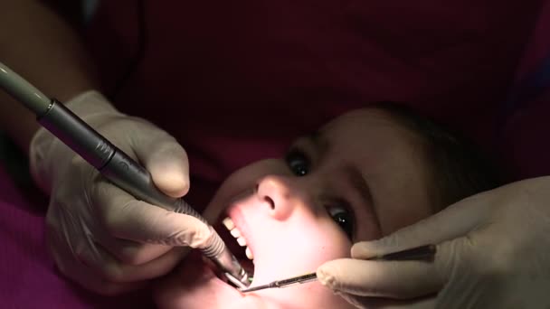 Behandling av melketenner hos barn, en lege borer en tann mot karies. – stockvideo