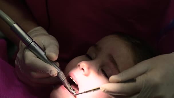 Behandlung von Babyzähnen bei einem Kind, ein Arzt bohrt einen Zahn für Karies. — Stockvideo
