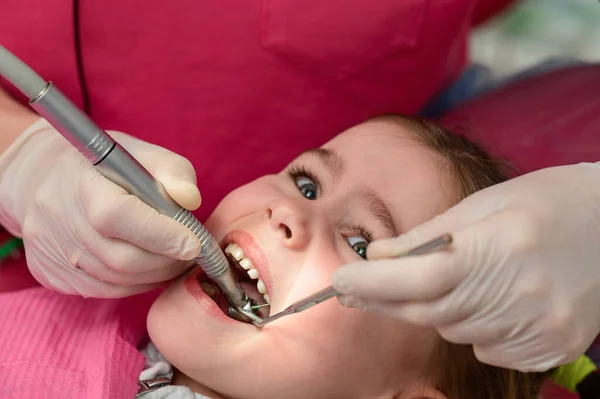 Der Kinderzahnarzt Behandelt Die Zähne Des Kindes Untersuchung Des Zahnes — Stockfoto