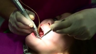 Bir çocukta bebek dişi tedavisi, bir doktor bakımı için dişlerini döker..