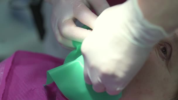 Il dentista stabilisce le casse dei pazienti, la procedura dentale, il trattamento dentale moderno. — Video Stock