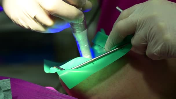 Зубной ультрафиолет и резиновые плотины используются стоматологом для лечения зубов. — стоковое видео