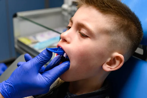 Kieferabdruck Mit Silikon Diagnosemodell Schiefe Zähne Beim Kind Besuch Beim — Stockfoto