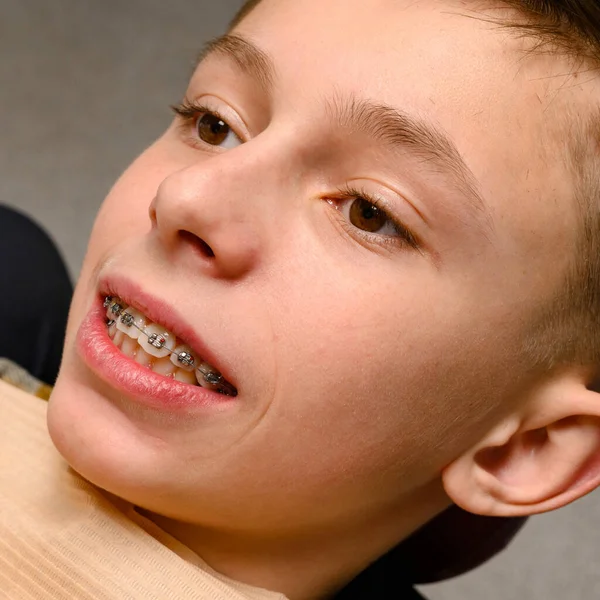 Diş Teli Diş Teli Olan Hastanın Diş Hekimine Düzenli Bir — Stok fotoğraf