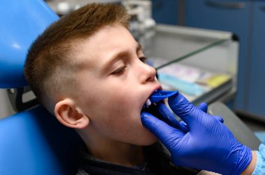 Çene izi silikon tanı modeli, çarpık dişler, ortodontiste bir ziyaret..