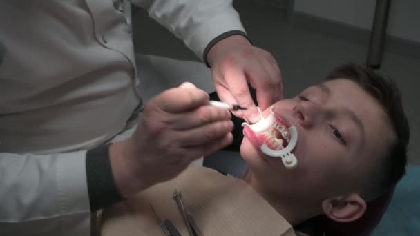 在安装假牙时使用紫外光 在假牙上颌骨安装假牙 用牙齿矫形师提供的紫外光录像 — 图库视频影像