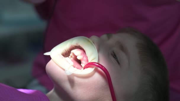 Tratamento Dentes Leite Uma Criança Médico Perfura Dente Para Cárie — Vídeo de Stock